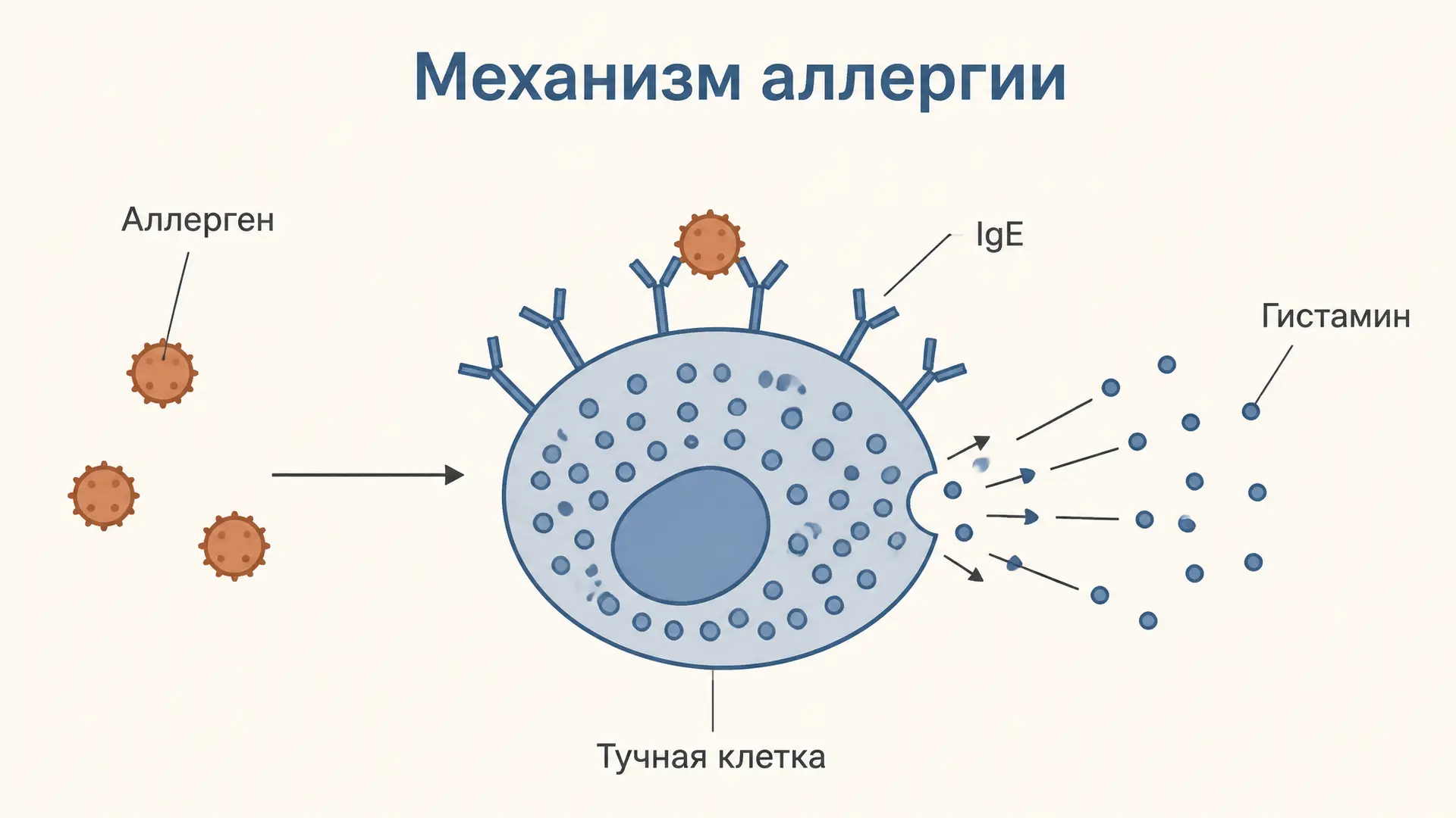 Аллергия: механизм развития реакции на аллерген