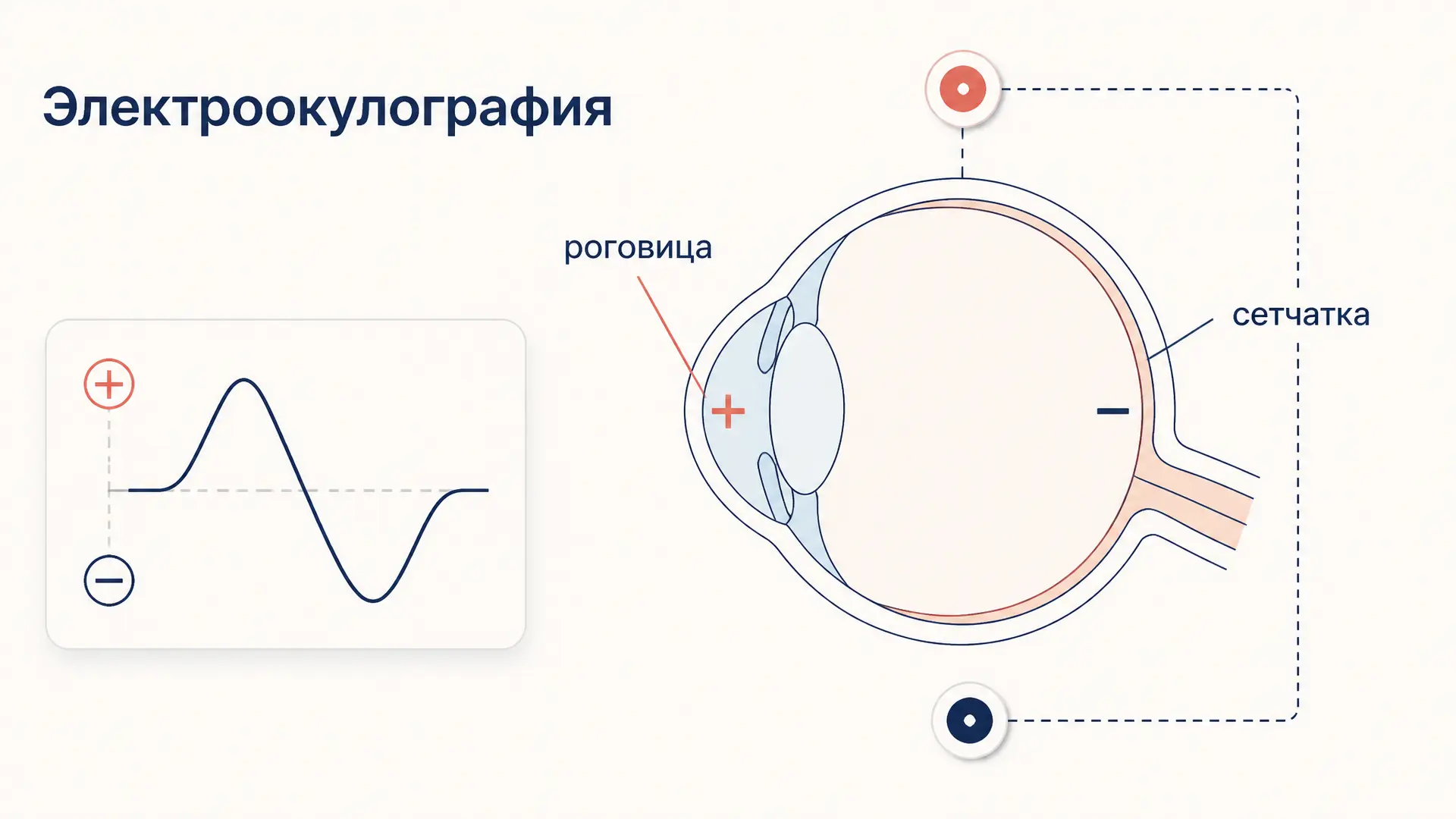 Электроокулография: как записывают движения глаз
