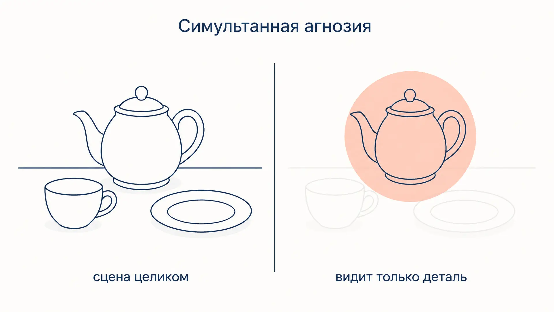 Симультанная агнозия: как мозг теряет целое