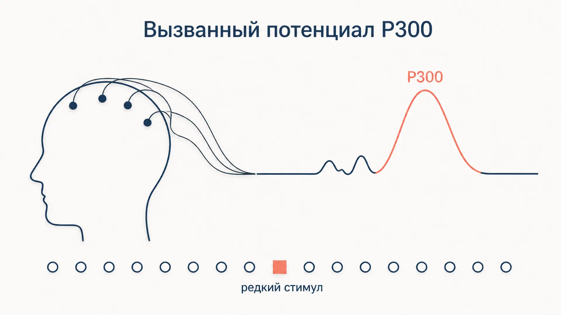 Вызванный потенциал P300: что это и как его измеряют