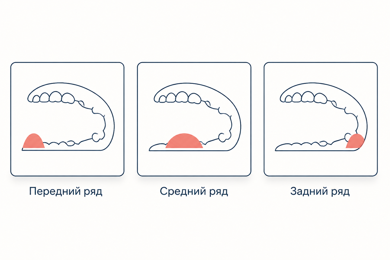 Три схемы полости рта: язык поднят передней частью, средней и задней, что даёт передний, средний и задний ряд гласных