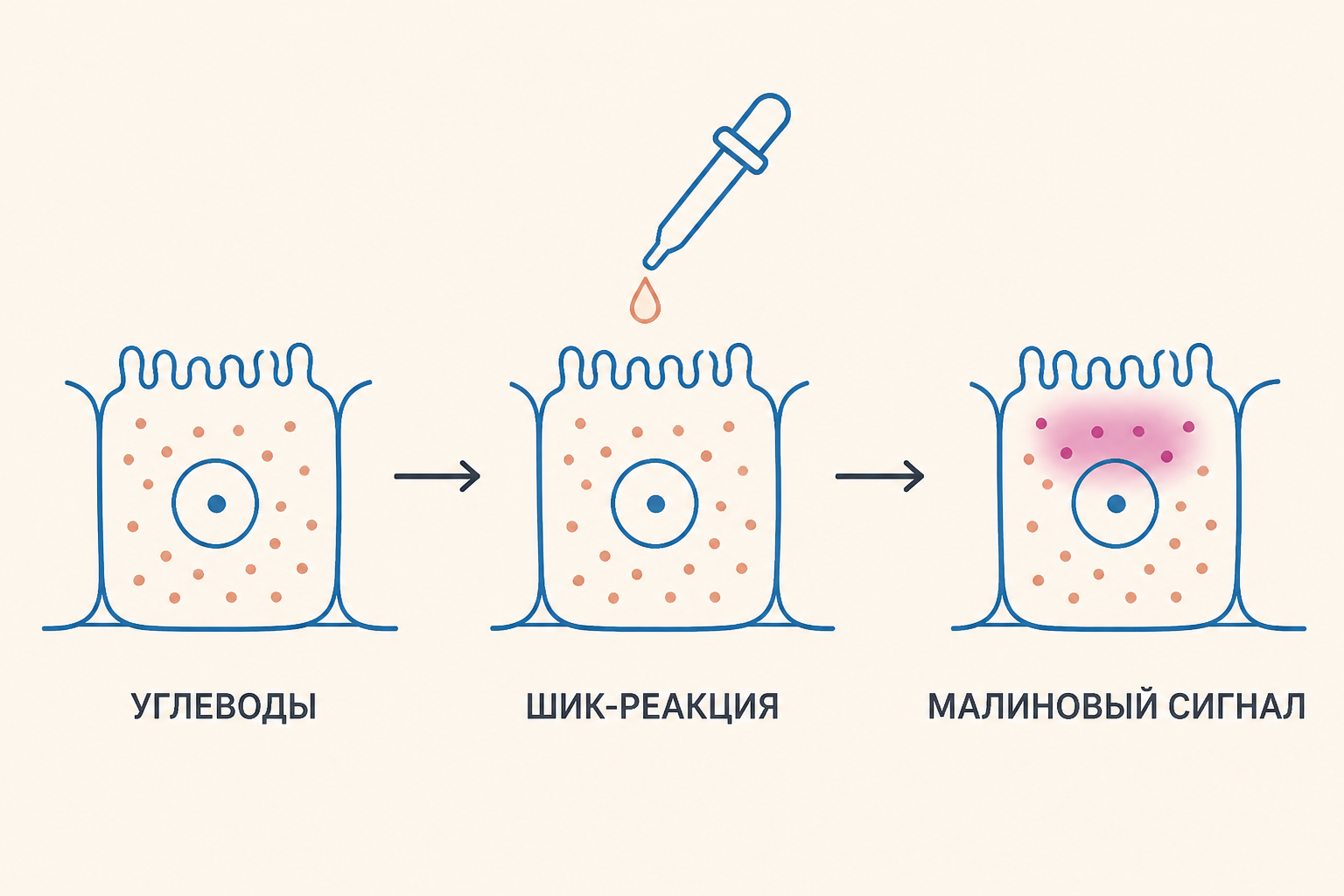 Схема ШИК-реакции: периодная кислота превращает углеводные группы в видимый малиновый сигнал в ткани