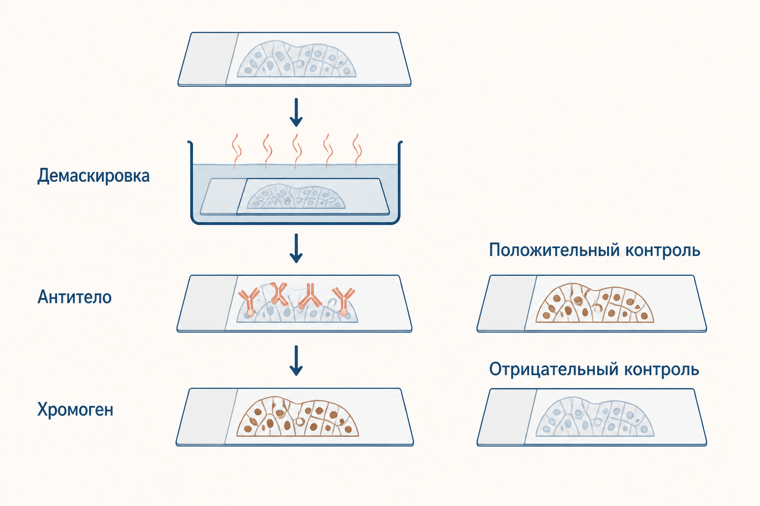 Сравнение прямой и непрямой иммуногистохимии: во втором случае вторичное антитело помогает усилить детекцию