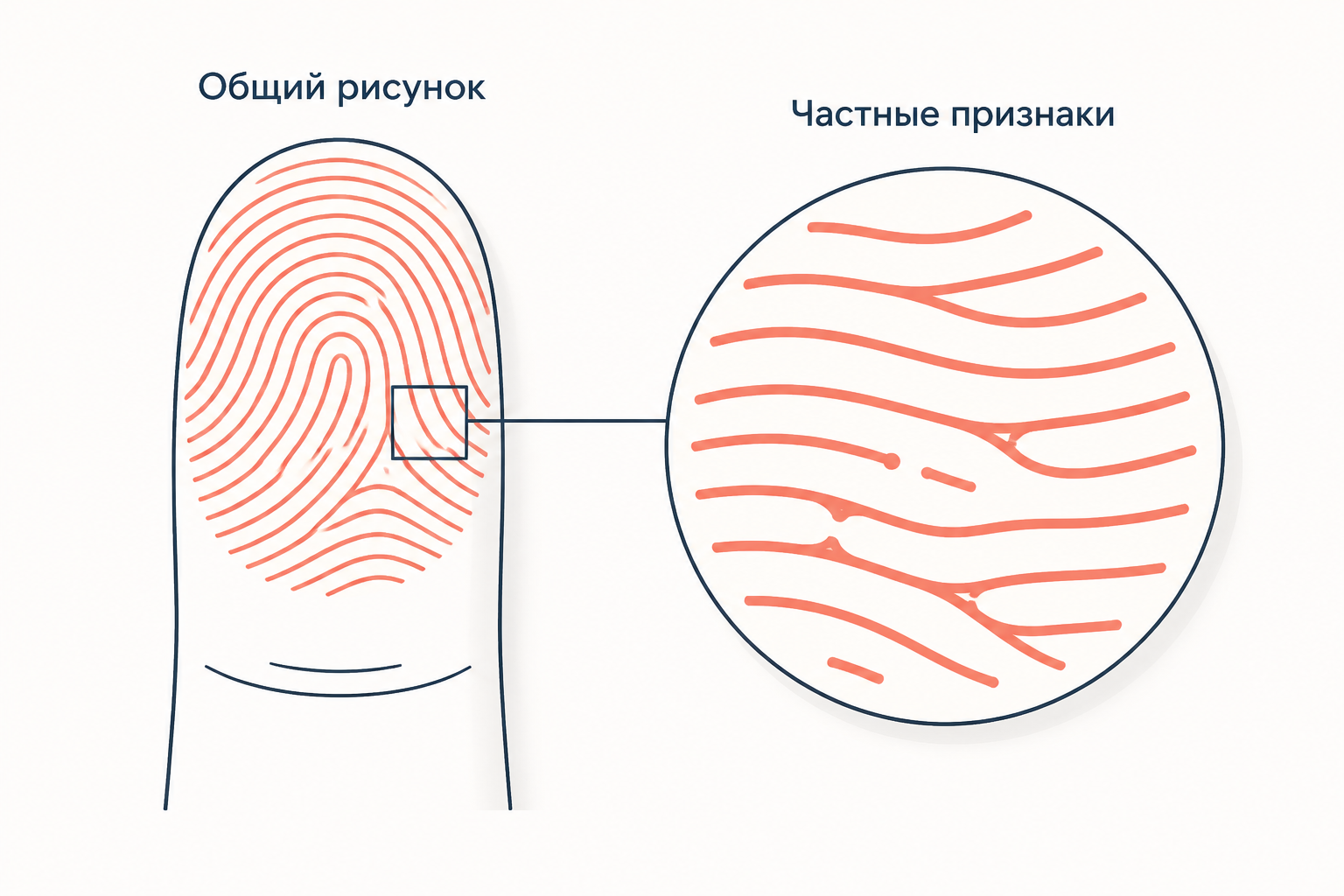 Общий рисунок и частные признаки папиллярного узора