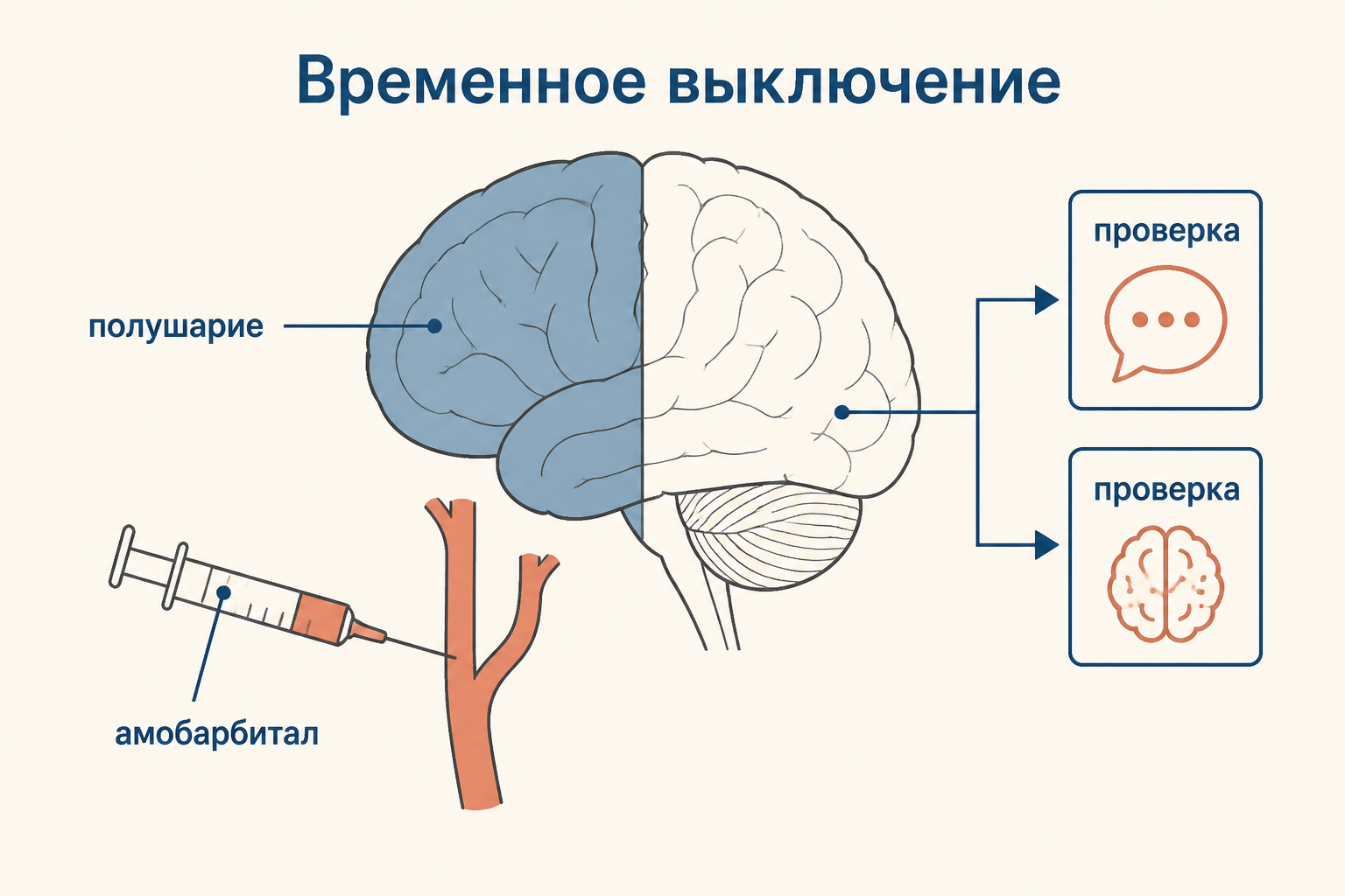 Схема теста Вады: препарат временно снижает работу одного полушария, а нейропсихолог проверяет речь и память